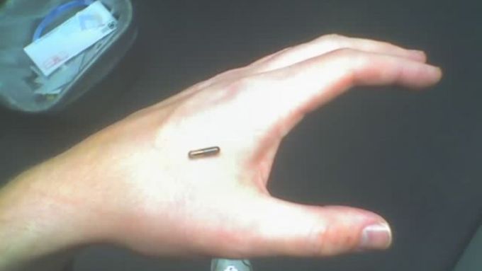 Ruka před zavedením čipu RFID...