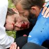 Zraněný Jack Bauer v 19. etapě Tour de France 2013