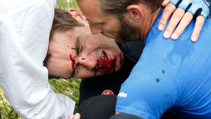 Novozélanďan Jack Bauer při nehodě v 19. etapě vlétl do ostnatého drátu