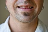 Vypadlý nebo ztracený zub: Sen, v němž velmi živě zažíváte pocit, že jste přišli o část svého chrupu, může ve skutečnosti znamenat, že se trápíte obtížnou a nepříjemnou komunikací, ať už se svým šéfem nebo s partnerem.