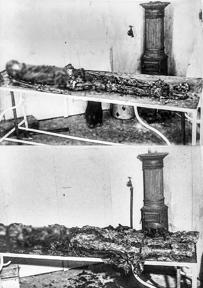 Ostatky těl zavražděných bratří Polických. Archivní snímek byl pořízený na pitevně. Koláž dvou snímků