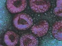 Virus H5N1 pod mikroskopem