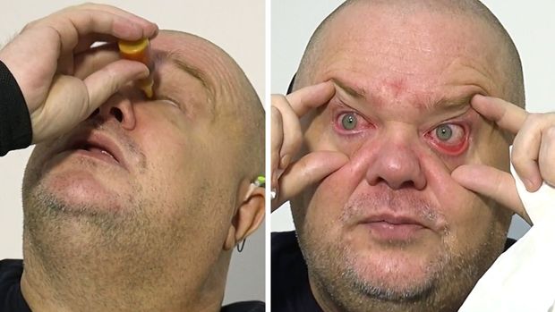 "Jen tak ještě uvidím svého syna." Příběh muže, který si do očí kape extrémní chilli