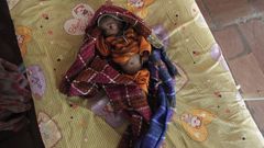 Podvyživené děti v Indii