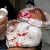 Aleppo - útok - dítě - březen 2014