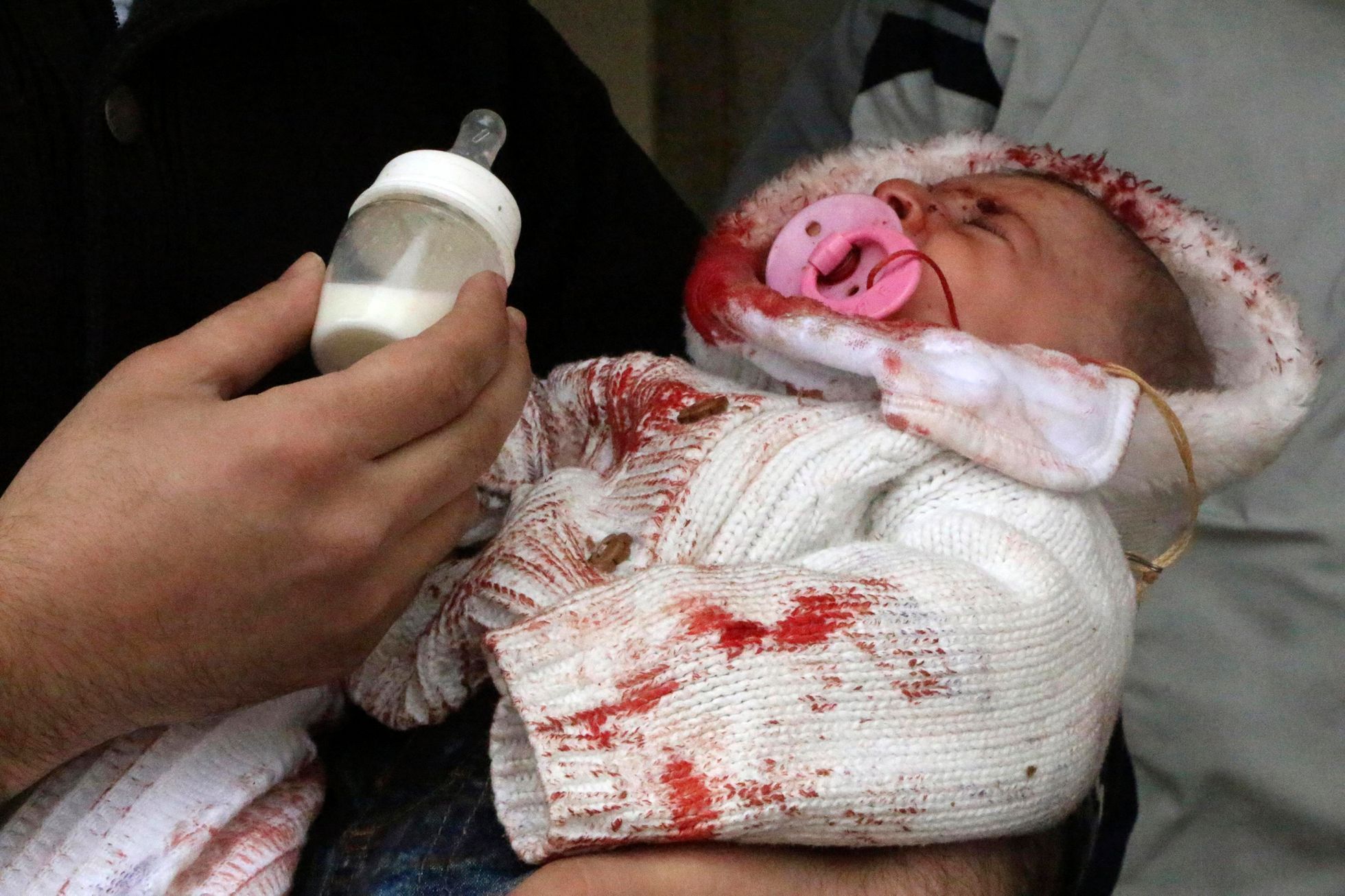 Aleppo - útok - dítě - březen 2014