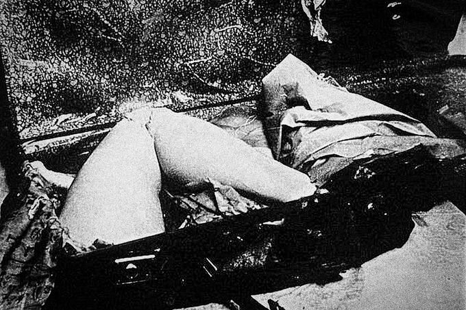 Amputovaná část nohy zavražděné ženy Otýlie Vranské. Nedatovaná fotografie z policejního vyšetřování (cca 30. léta 20. století)