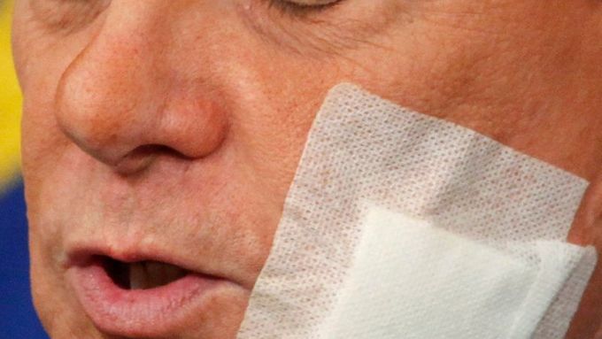 Silvio Berlusconi s náplastí po plastické operaci, kterou před časem prodělal