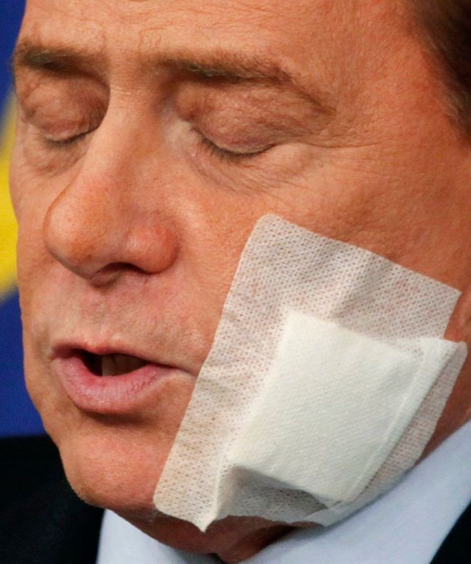 Silvio Berlusconi s náplastí po plastické operaci