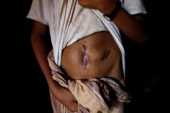 Utekla jsem z masového hrobu. Z Barmy se valí další hrozivá svědectví Rohingů, armáda vinu popírá