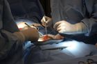 Lékaři v USA úspěšně transplantovali prasečí ledvinu člověku. Hovoří o milníku