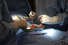 Lékaři v USA úspěšně transplantovali prasečí ledvinu člověku. Hovoří o milníku