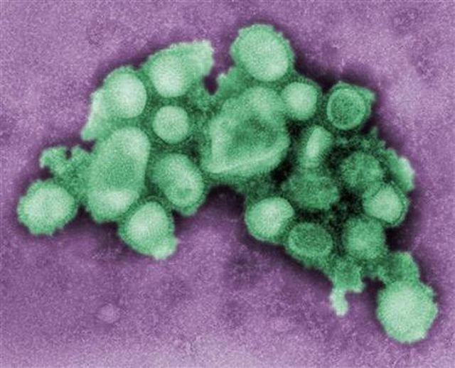 Virus prasečí chřipky prasečí chřipka