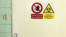 Neštovice, ebola a další: Jak vypadají nejhorší viry a co provedou s lidským tělem?