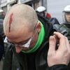 Fotogalerie: Boj belgických ocelářů proti propouštění