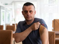 Monokl a modřiny podle Oleha pocházejí z potyčky s pracovníky TCK, ukrajinské obdoby vojenské správy, která má na starost mobilizaci.