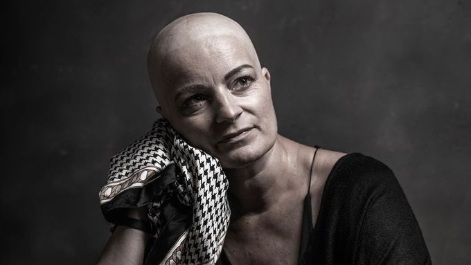 Šátková výzva. Fotografka svou výstavou podpořila ženy procházející chemoterapií