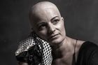 Šátková výzva. Fotografka svou výstavou podpořila ženy procházející chemoterapií