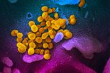 Na tomto snímku je virus SARS-CoV-2 zobrazen ve žluté barvě.