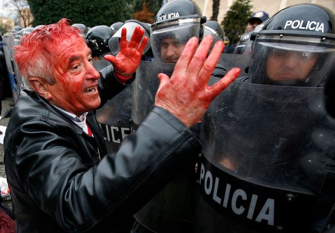 Muž, zraněný při protivládní demonstraci, spílá nasazeným pořádkovým policistům v centru Tirany.