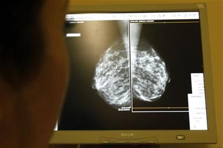 Mamograf (mammograf)
