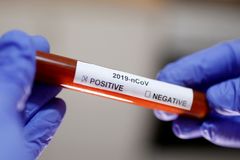 V Česku se objevily první případy koronaviru. Všichni přijeli ze severní Itálie