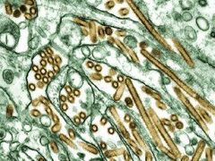 Zbarvený snímek z elektronového miroskopu ukazuje viry ptačí chřipky H5N1 (zlatá barva) mezi buňkami (zelené).