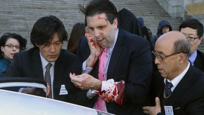 Americký velvyslanec v Jižní Koreji Mark Lippert po napadení neznámým útočníkem.