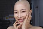 Youtuberka si oholila hlavu, ukazuje náročný boj s rakovinou. Nestydím se za to, říká