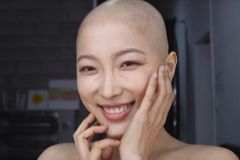 Youtuberka si oholila hlavu, ukazuje náročný boj s rakovinou. Nestydím se za to, říká