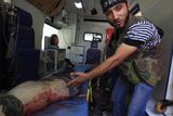 Nemocnice v Aleppu podle Reuters denně přijímají až 40 zraněných. Na fotografii ukazuje jeden z povstalců na tělo civilisty, který svým zraněním podlehl ještě před odvozem do nemocnice.