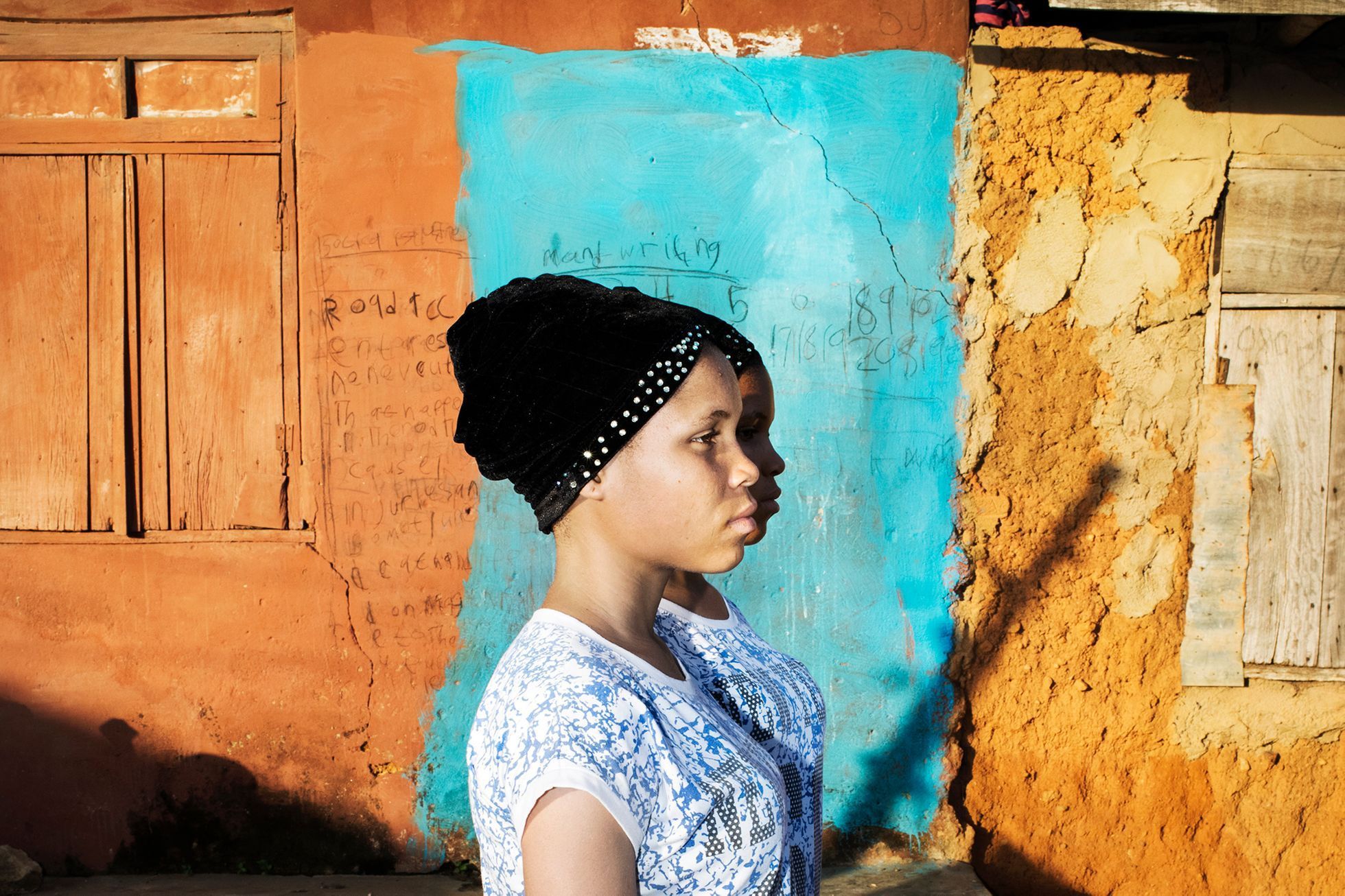 NEPOUŽÍVAT OPAKOVANĚ!!! Nigérie, dvojčata