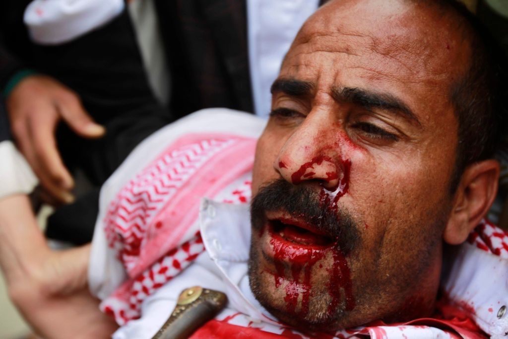 Jemen - zraněný demonstrant