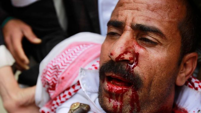 Muž zraněný při páteční demonstraci proti jemenskému prezidentu Sálihovi