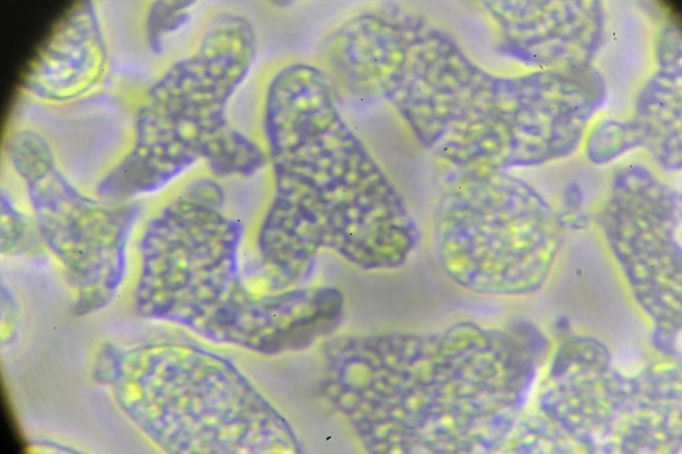 Améba Naegleria fowleri  v kultuře. Mikroskopický snímek