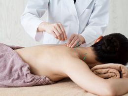 Akupunktura: Lék pro každého. Zbaví bolesti, vrásek i kil navíc