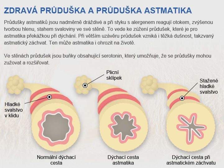 Co při Astmatickem Zachvatu?