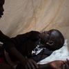 Jižní Súdán - MSF