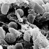 Mor, morová bakterie, Yersinia pestis