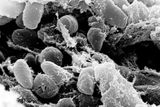 Mikroskopická zvětšenina bakterie Yersinia pestis - je původcem pravého moru.