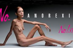 28 let, tělo stařeny. Modelku Carovou zabila anorexie