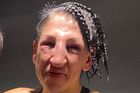 Boxerka inkasovala při zápase 236 úderů. Její tvář znetvořily k nepoznání
