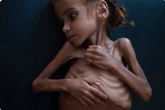 Její snímek se stal symbolem hladomoru. Sedmiletá dívenka z Jemenu zemřela