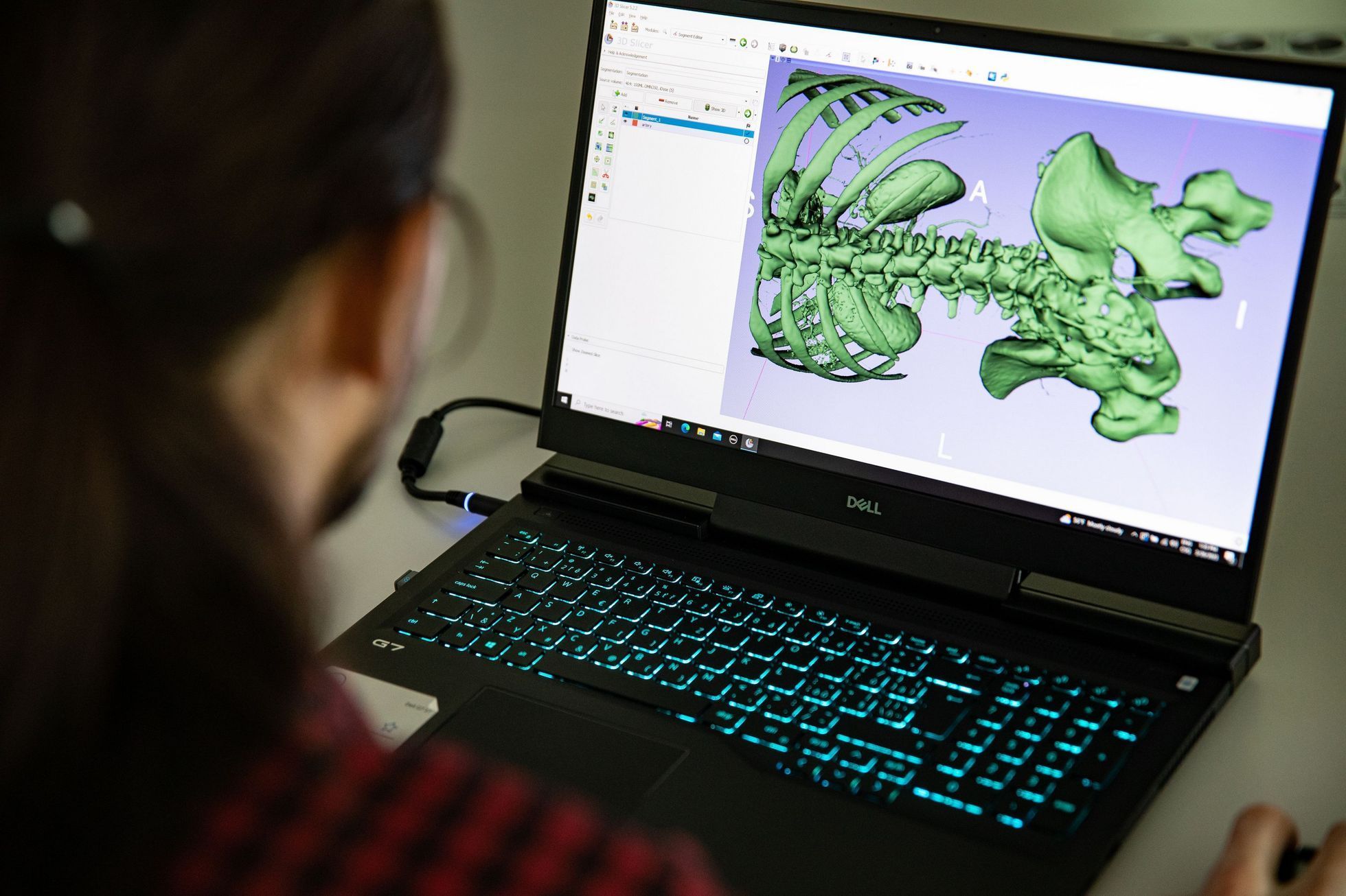 3D tisk lidské tělo