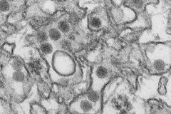 Zika napadá kmenové buňky, z nichž se vytváří lidský mozek, zjistila studie