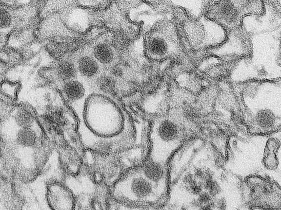 Brněnští vědci se podílejí na zkoumání viru zika