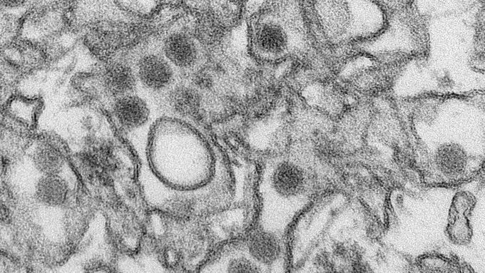 Virus zika, ilustrační foto