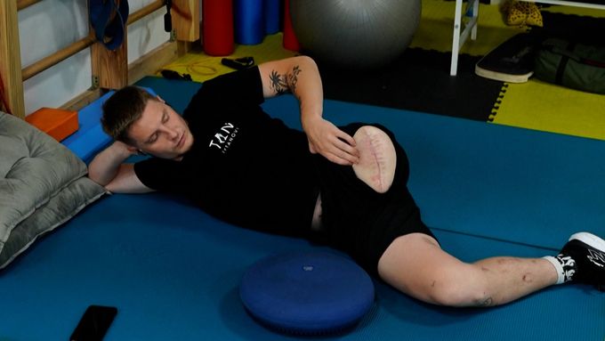 Oleksij promluvil o tom, jak přišel o nohu na bojišti