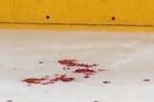 VIDEO Hokejový masakr. Po tvrdém hitu praskla lebka