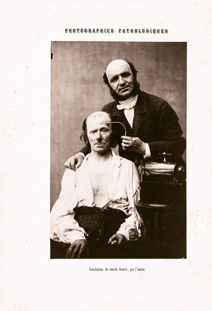 Výrazy ve tvářích po stimulaci elektrodou: Guillaume Benjamin Amand Duchenne de Boulogne a Adrien Tournachon, 1854–56